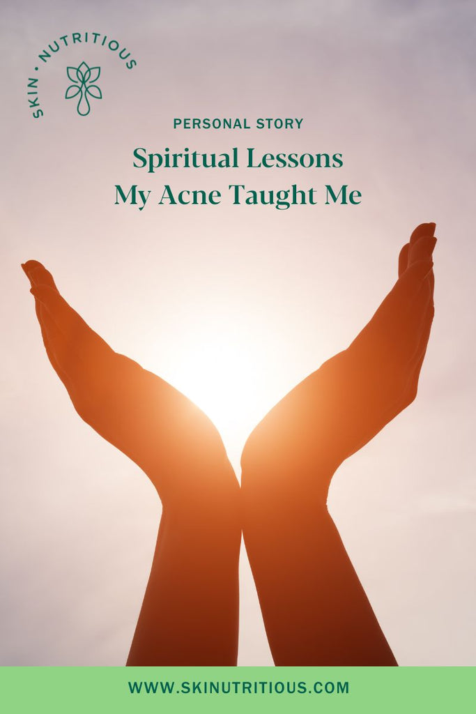 Spiritual Lessons My Acne Taught Me
