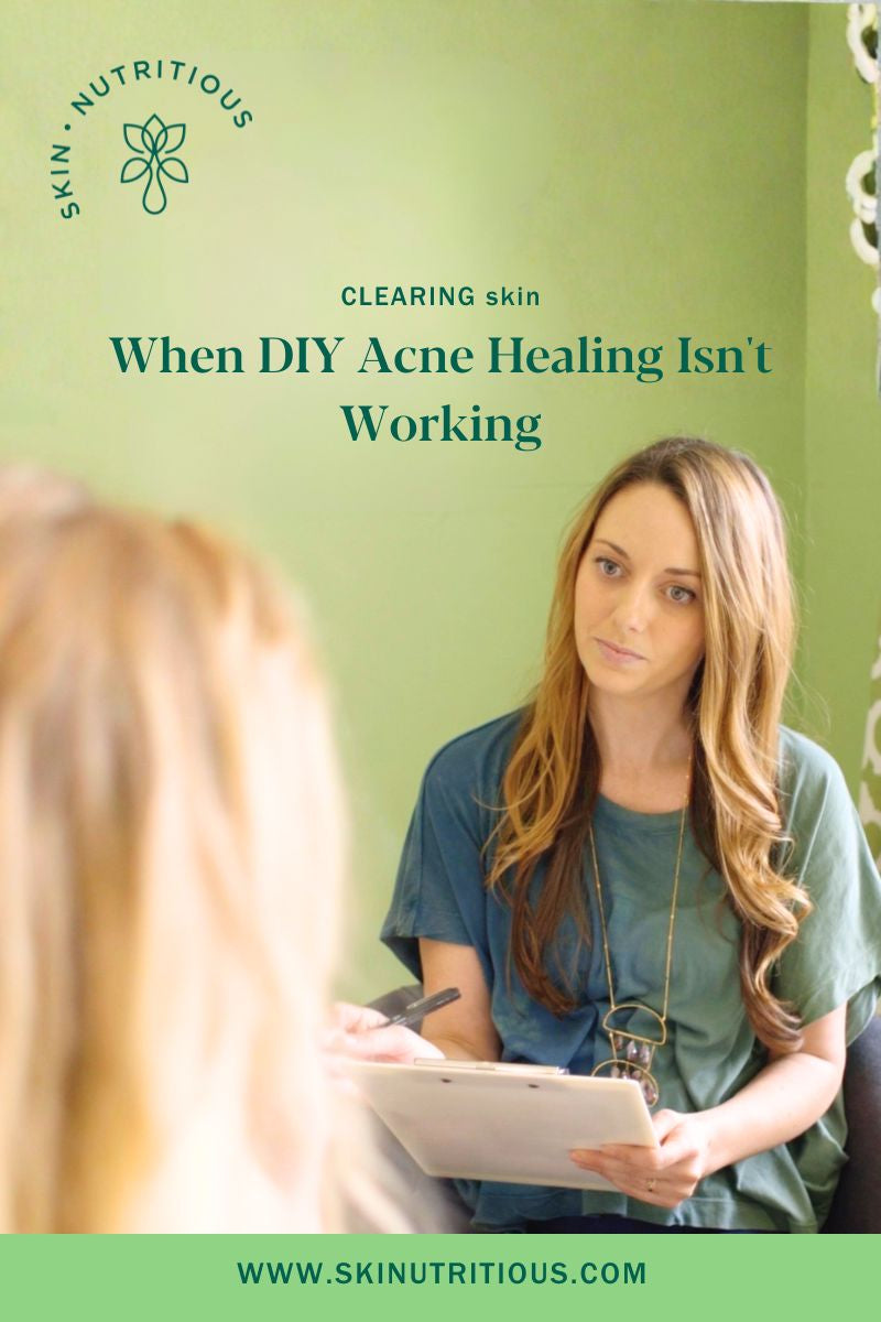 When DIY Acne Healing Isn't Working