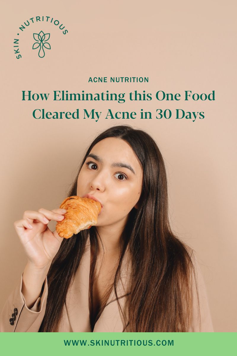 How Eliminating This One Food Cleared My Acne in 30 Days