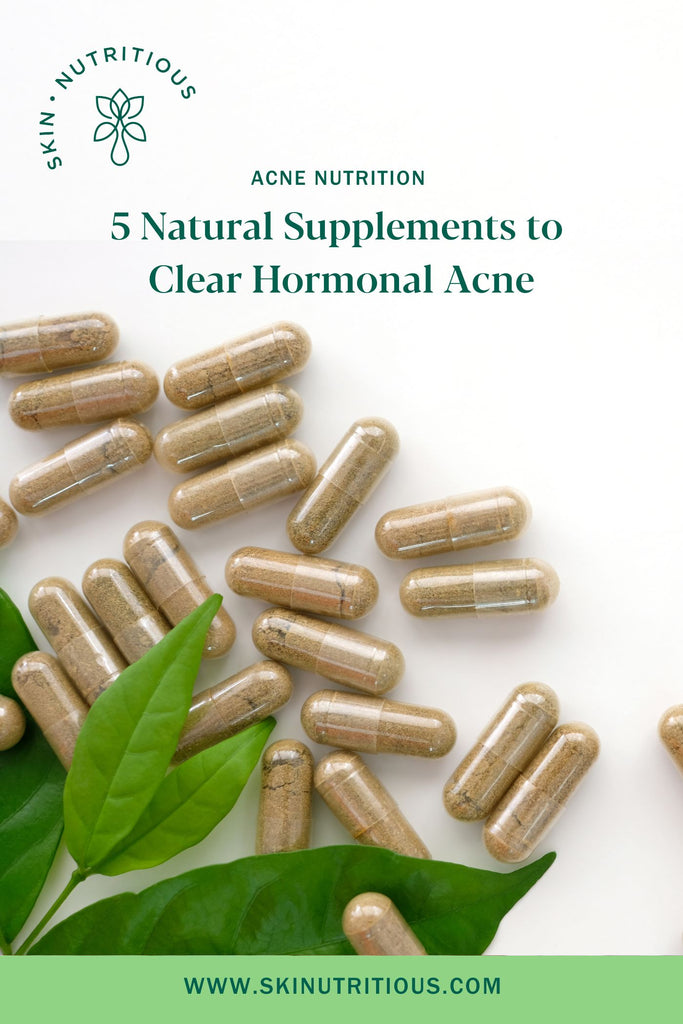 Natural, Herbal Supplements to Clear Hormonal Acne