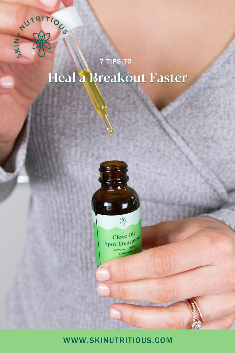 7 Tips to a Heal a Breakout Faster