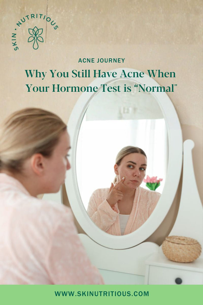 Why You Still Have Acne When Your Hormone Test is "Normal"